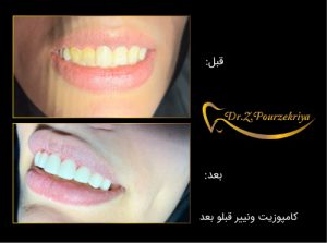 متخصص ایمپلنت در البرز