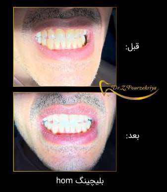 بهترین دندانپزشک در البرز