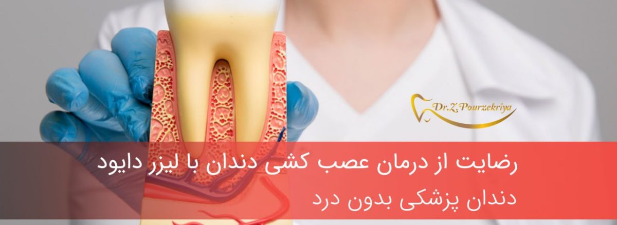 عصب کشی دندان