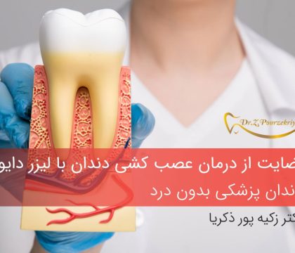 عصب کشی دندان