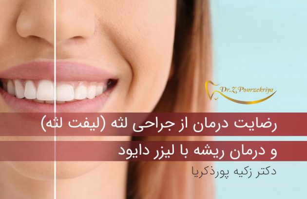 درمان ریشه با لیزر دایود