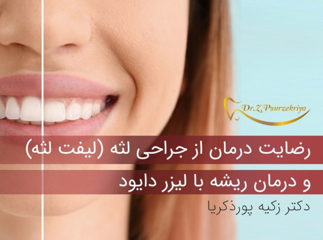 درمان ریشه با لیزر دایود