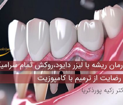 درمان ریشه با لیزر دایود